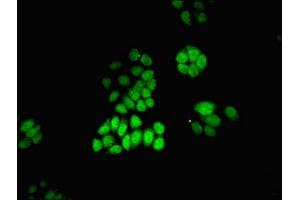 Immunofluorescent analysis of PC-3 cells using ABIN7168530 at dilution of 1:100 and Alexa Fluor 488-congugated AffiniPure Goat Anti-Rabbit IgG(H+L) (MAT2A Antikörper  (AA 1-395))