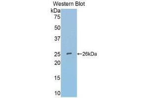 Western Blotting (WB) image for anti-Secreted Frizzled-Related Protein 4 (SFRP4) (AA 25-222) antibody (ABIN3203489) (SFRP4 Antikörper  (AA 25-222))