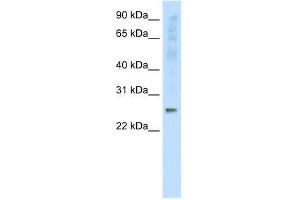 Western Blot showing SNAP25 antibody used at a concentration of 1-2 ug/ml to detect its target protein. (SNAP25 Antikörper  (C-Term))
