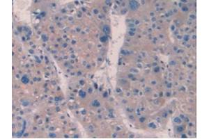 IHC-P analysis of Human Liver Tissue, with DAB staining. (IL10RB Antikörper  (AA 87-243))
