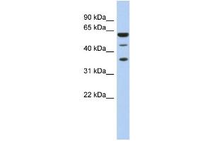 WB Suggested Anti-RDBP Antibody Titration:  0. (RDBP Antikörper  (N-Term))