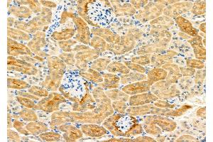 ABIN6265115 and ABIN6276896 at 1/100 staining Mouse kidney tissue by IHC-P. (SLC22A6 Antikörper  (C-Term))