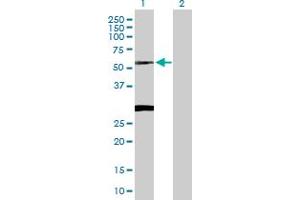 Western Blot analysis of CLN3 expression in transfected 293T cell line by CLN3 MaxPab polyclonal antibody. (CLN3 Antikörper  (AA 1-438))