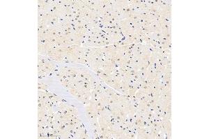 Immunohistochemistry of paraffin embedded rat heart using HDAC (ABIN7074234) at dilution of 1:1200 (300x lens) (HDAC11 Antikörper)