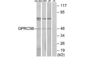 Western blot analysis of extracts from HUVEC cells, 293cells and Jurkat cells, using GPRC5B antibody.