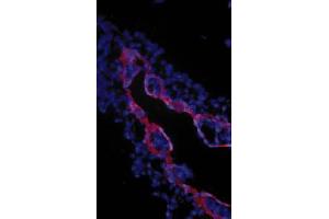 Image no. 1 for anti-Transforming Growth Factor, beta Receptor III (TGFBR3) (Extracellular Domain) antibody (ABIN265019) (TGFBR3 Antikörper  (Extracellular Domain))