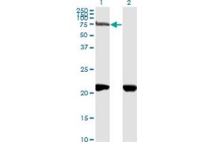 Western Blotting (WB) image for anti-Neuropilin 1 (NRP1) (AA 22-131) antibody (ABIN1327097)