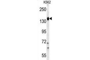 Western Blotting (WB) image for anti-Phosphoinositide-3-Kinase, Catalytic, gamma Polypeptide (PIK3CG) antibody (ABIN3003633) (PIK3 gamma Antikörper)