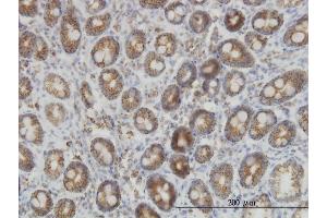 Immunoperoxidase of monoclonal antibody to IDH2 on formalin-fixed paraffin-embedded human colon. (IDH2 Antikörper  (AA 354-451))