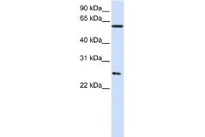 WB Suggested Anti-CCT7 Antibody Titration: 0. (CCT7 Antikörper  (Middle Region))
