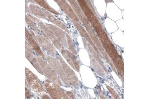 Immunohistochemical staining (Formalin-fixed paraffin-embedded sections) of human skeletal muscle with PGM1 monoclonal antibody, clone CL3299  shows moderate cytoplasmic immunoreactivity in muscle fibers. (Phosphoglucomutase 1 Antikörper)