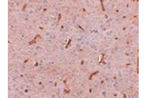 Immunohistochemistry of TWA1 in rat brain tissue with this product at 2.