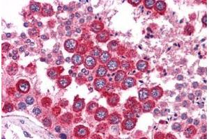 Immunohistochemistry (Formalin-fixed Paraffin-embedded Sections) (IHC (fp)) image for anti-Wingless-Type MMTV Integration Site Family, Member 2B (WNT2B) (N-Term) antibody (ABIN6745721)