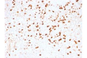 Formalin-fixed, paraffin-embedded human Tonsil stained with Lambda Light Chain Monoclonal Antibody (N10/2). (IgL Antikörper)