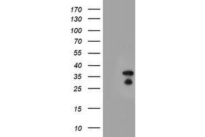 Western Blotting (WB) image for anti-Hes Family bHLH Transcription Factor 1 (HES1) antibody (ABIN1498633) (HES1 Antikörper)