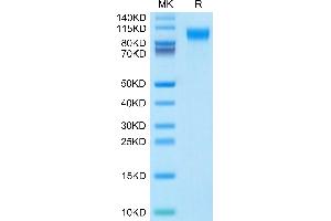 IL31RA Protein (AA 19-499) (His tag)