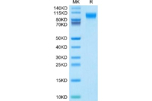 IL31RA Protein (AA 19-499) (His tag)