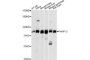 Western blot analysis of extracts of various cell lines, using PARP12 antibody. (PARP12 Antikörper)