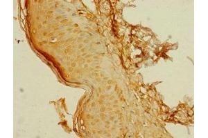 Immunohistochemistry of paraffin-embedded human skin tissue using ABIN7174896 at dilution of 1:100 (C8orf34 Antikörper  (AA 1-300))