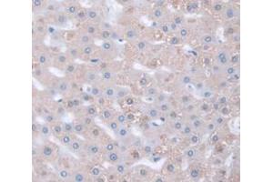 IHC-P analysis of Human Tissue, with DAB staining. (HSPG2 Antikörper  (AA 4149-4391))