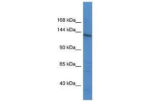 WB Suggested Anti-LTBP1 Antibody Titration: 0. (LTBP1 Antikörper  (C-Term))