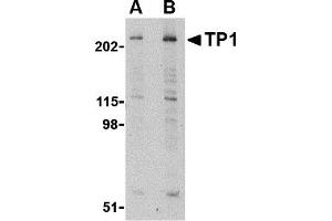 Western Blotting (WB) image for anti-Transition Protein 1 (During Histone To Protamine Replacement) (TNP1) (N-Term) antibody (ABIN1031638) (TNP1 Antikörper  (N-Term))