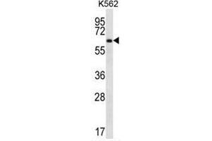 ZNF623 Antibody (C-term) western blot analysis in K562 cell line lysates (35 µg/lane). (ZNF623 Antikörper  (C-Term))