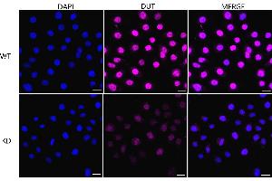 Immunocytochemical staining of HeLa cells using DUT antibody (ABIN7798312), 1:1,000), Top panel: wild-type (WT), Bottom panal: DUT shRNA knockdown (KD). (Rekombinanter Deoxyuridine Triphosphatase (DUT) Antikörper)