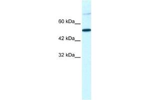WB Suggested Anti-TBX3 Antibody Titration:  1. (TBX3 Antikörper  (Middle Region))