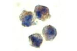 Immunocytochemistry of IL22RA1 in HepG2 cells with IL22RA1 polyclonal antibody  at 10 ug/mL .