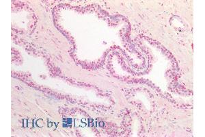 ABIN5539626 (5µg/ml) staining of paraffin embedded Human Prostate.