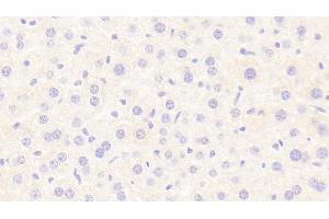 Detection of LIPC in Mouse Liver Tissue using Polyclonal Antibody to Lipase, Hepatic (LIPC) (LIPC Antikörper  (AA 159-415))