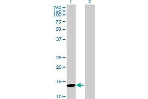 Western Blot analysis of MAP1LC3C expression in transfected 293T cell line by MAP1LC3C MaxPab polyclonal antibody. (LC3C Antikörper  (AA 1-147))