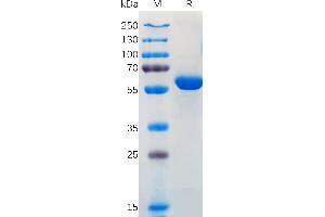 SDS-PAGE (SDS) image for SARS-CoV-2 Spike (B.1.617.1 - kappa), (RBD) protein (Fc Tag) (ABIN7490651)