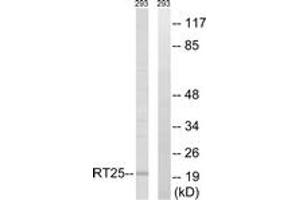 Western blot analysis of extracts from 293 cells, using MRPS25 Antibody.