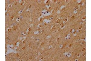 IHC image of ABIN7146440 diluted at 1:200 and staining in paraffin-embedded human brain tissue performed on a Leica BondTM system. (CAMK2A Antikörper  (AA 321-478))