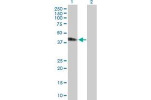 Western Blot analysis of IFNAR2 expression in transfected 293T cell line by IFNAR2 MaxPab polyclonal antibody. (IFNAR2 Antikörper  (AA 1-331))
