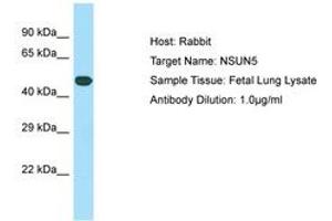 Image no. 1 for anti-NOP2/Sun Domain Family, Member 5 (NSUN5) (C-Term) antibody (ABIN6749897) (NSUN5 Antikörper  (C-Term))