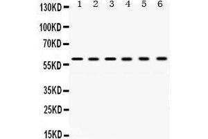 Western Blotting (WB) image for anti-T-Complex 1 (TCP1) (AA 515-551), (C-Term) antibody (ABIN3043417)