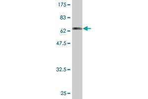 Western Blot detection against Immunogen (63. (CAPG Antikörper  (AA 1-348))