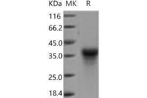 Western Blotting (WB) image for C-Type Lectin Domain Family 5, Member A (CLEC5A) protein (His tag) (ABIN7321165) (CLEC5A Protein (His tag))