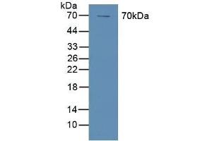 Detection of COX-1 in Human A431 Cells using Polyclonal Antibody to Cyclooxygenase 1 (COX-1) (PTGS1 Antikörper  (AA 367-599))