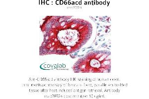 Image no. 2 for anti-Carcinoembryonic Antigen-Related Cell Adhesion Molecule 1/3/6 (CEACAM1/3/6) antibody (ABIN1723246)