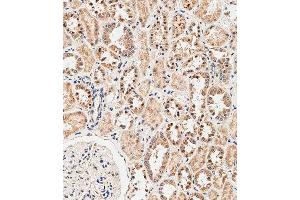 Immunohistochemical analysis of paraffin-embedded human kidney tissue using C performed on the Leica® BOND RXm. (NOX1 Antikörper  (AA 243-271))