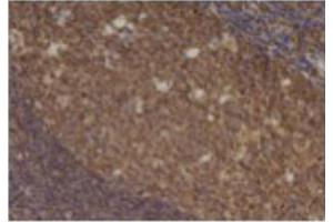 Image no. 3 for anti-Chemokine (C-C Motif) Ligand 5 (CCL5) antibody (ABIN465158) (CCL5 Antikörper)