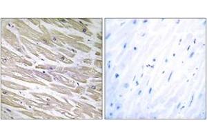 Immunohistochemistry analysis of paraffin-embedded human heart tissue, using LAMA4 Antibody. (LAMa4 Antikörper  (AA 481-530))