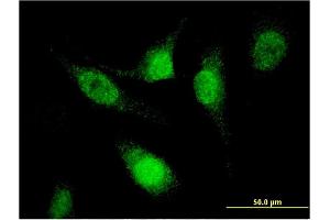 Immunofluorescence of monoclonal antibody to SFRS12 on HeLa cell.