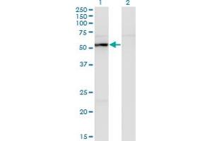Western Blot analysis of UAP1 expression in transfected 293T cell line by UAP1 monoclonal antibody (M01), clone 3A9. (UAP1 Antikörper  (AA 406-504))