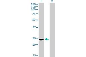 Western Blot analysis of C16orf5 expression in transfected 293T cell line by C16orf5 MaxPab polyclonal antibody. (CDIP1 Antikörper  (AA 1-208))