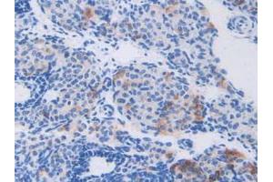 IHC-P analysis of Mouse Ovary Tissue, with DAB staining. (CAPNL1 Antikörper  (AA 387-694))